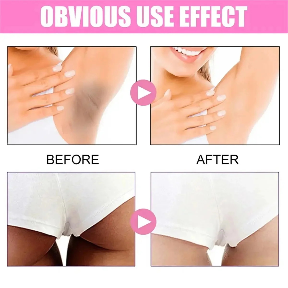 Fast Whitening Dark Knuckles B - Korean Lifestyle Products ulasan dan harga