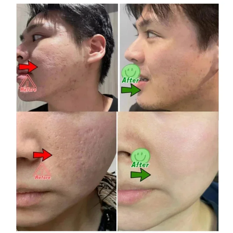 Salicylic Acid Pore Clearing C - Korean Lifestyle Products ulasan dan harga