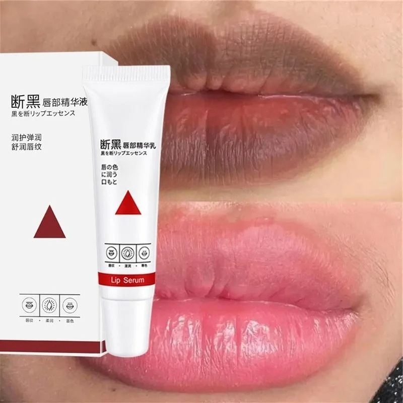 Remove Dark Lip Balm Fast Ligh - Korean Lifestyle Products ulasan dan harga