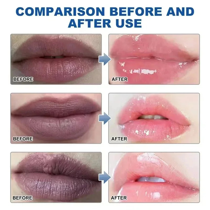 Remove Dark Lip Balm Fast Ligh - Korean Lifestyle Products ulasan dan harga