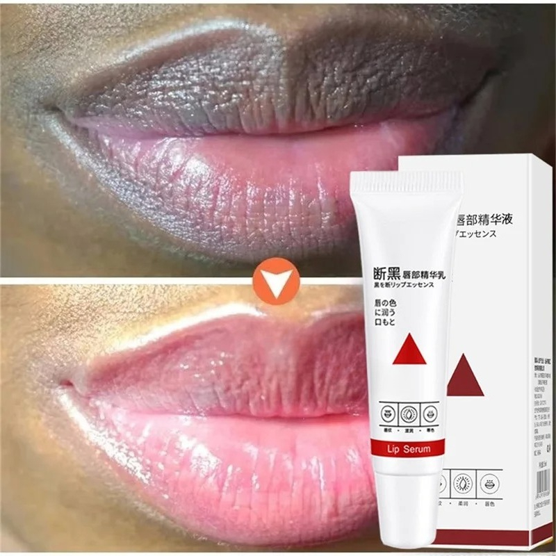 Remove Dark Lip Balm Fast Ligh - Korean Lifestyle Products ulasan dan harga